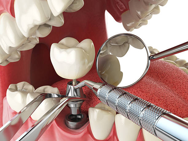Best Walk-In Emergency Dentist in Moodys, OK